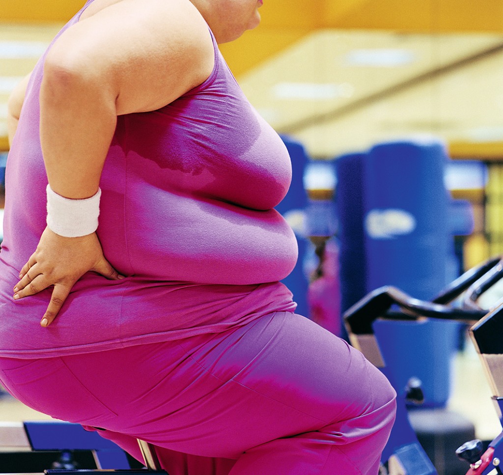 Campioni la obezitate