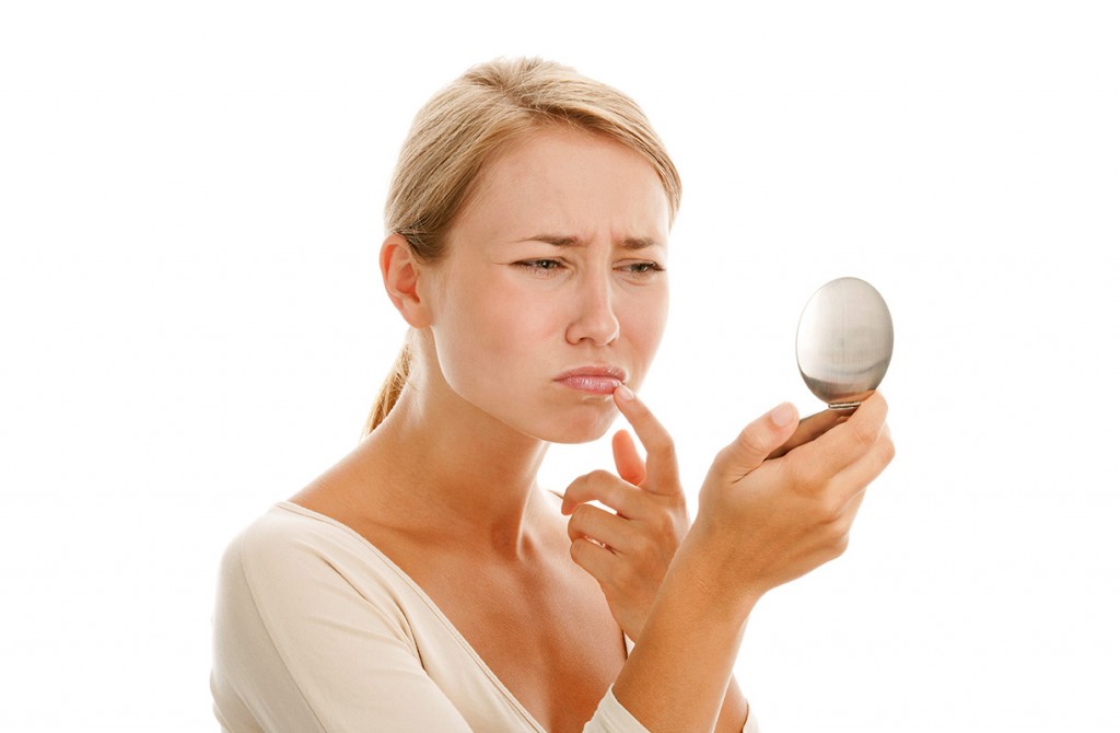 Virusul herpetic, microbul de care nu scapi