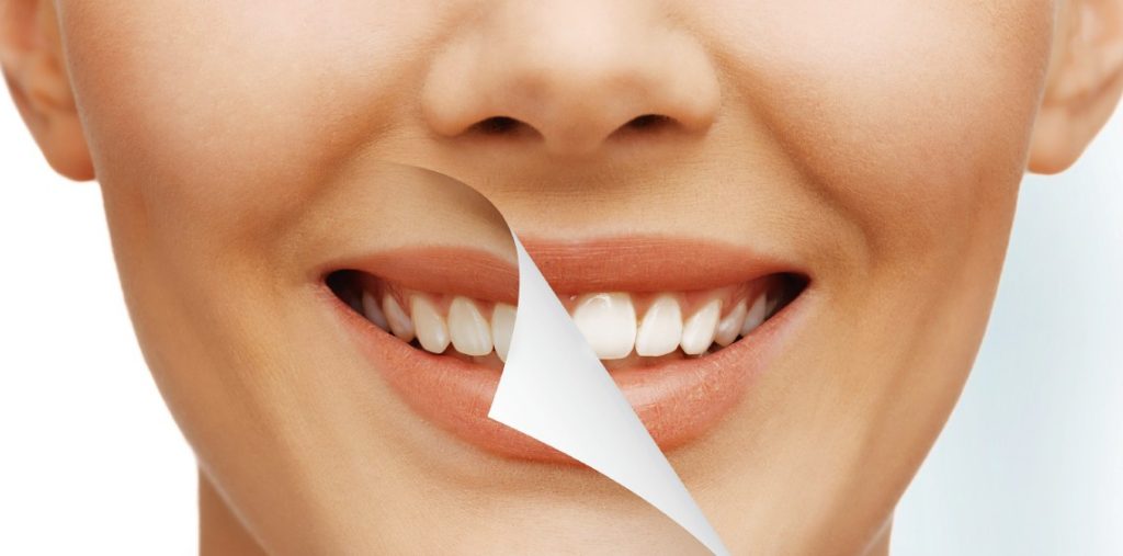 15 sfaturi pentru sănătatea dinților