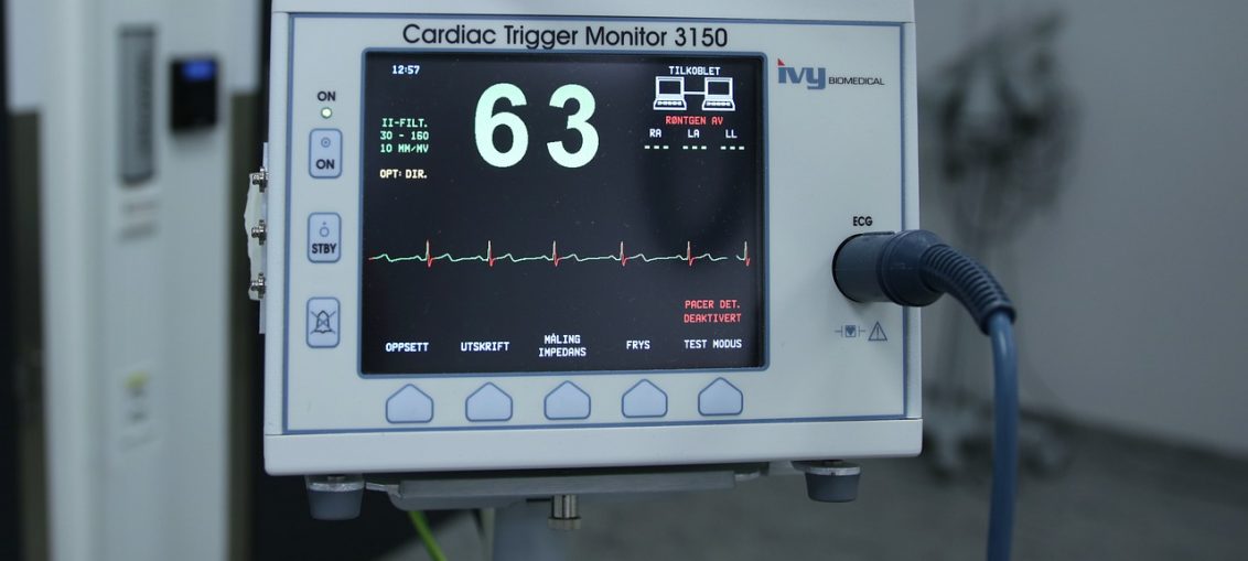 ce este ekg