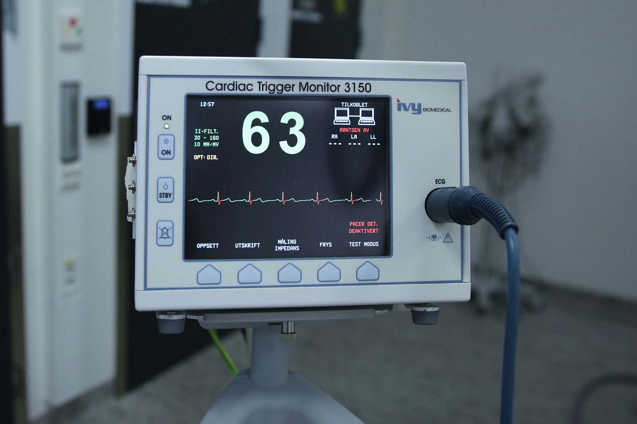 ce este ekg