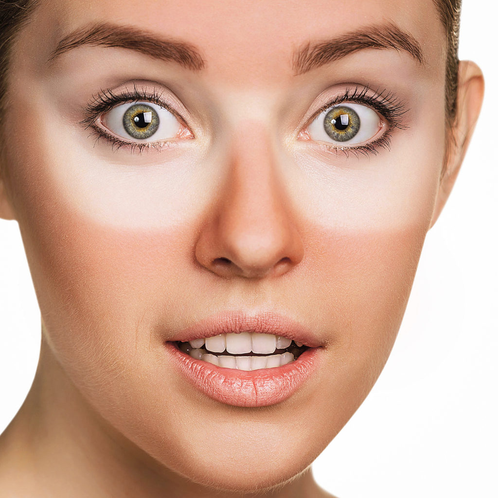 Arsurile solare, soluții naturale la îndemână