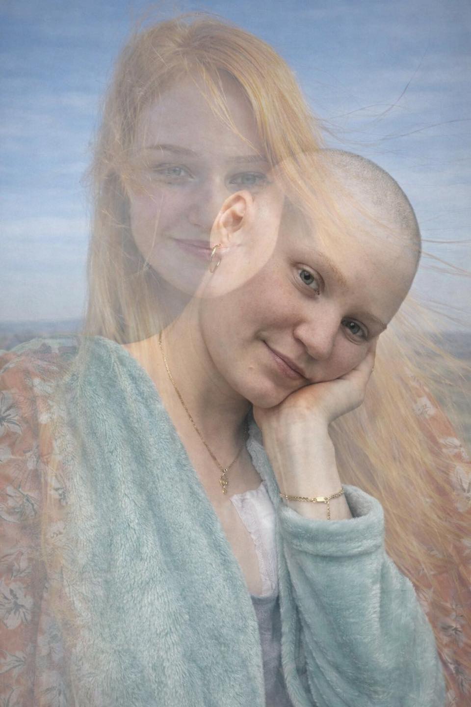 Din păcate, boala a transformat-o pe Andreea, dar nu i-a smuls și seninul chipului frumos (Sursa foto: Facebook Dani Cek)