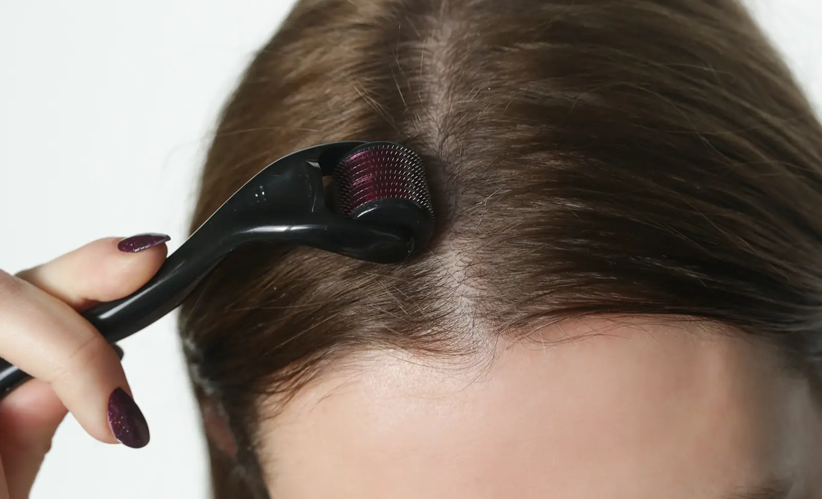 Derma roller pentru creșterea părului: cum funcționează și când dă rezultate, potrivit specialiștilor