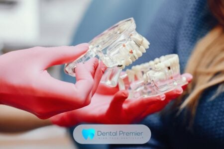 De la disconfort la căutarea soluțiilor: ce presupun dinții ficși pe 4 implanturi la Dental Premier?